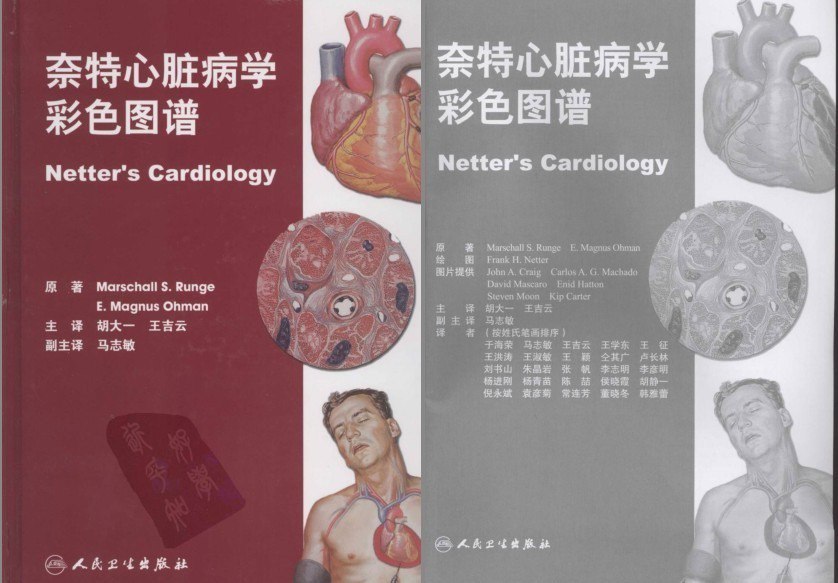 资源《《奈特心脏病学彩色图谱》全彩版 心血管疾病教科书[pdf]》的海报